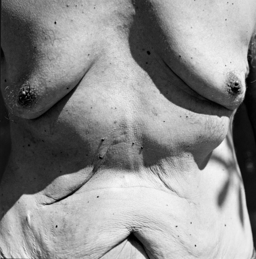 Disthanees (dead twice)